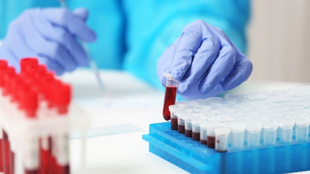 manitoba-reeve-concerned-about-laboratory-technologist-retention-in-rural-areas-despite-new-funds-for-training