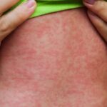 high-school,-er-among-3-new-measles-exposure-sites-in-southern-manitoba