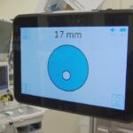 tiny-device-helps-provide-better-cancer-care-to-ns.-patients