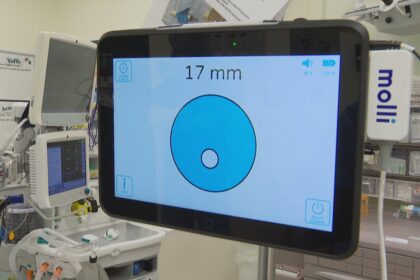 tiny-device-helps-provide-better-cancer-care-to-ns.-patients