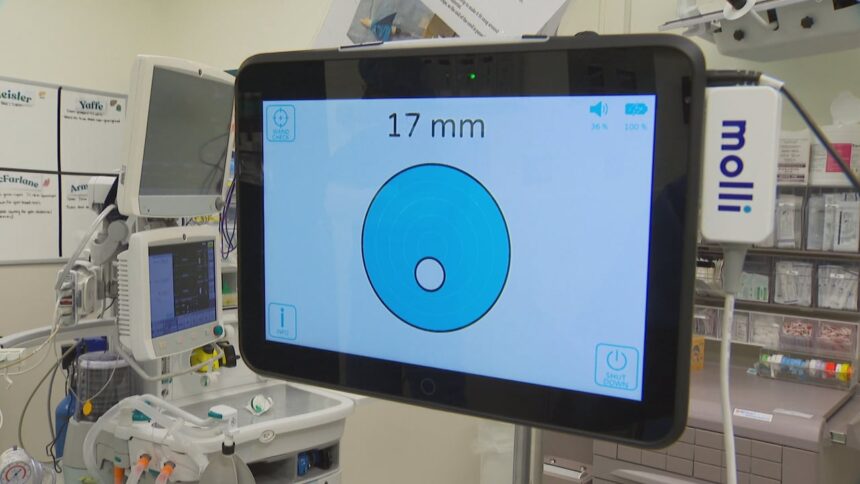 tiny-device-helps-provide-better-cancer-care-to-ns.-patients