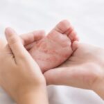 public-health-warns-of-measles-exposures-at-church,-arena-in-southern-manitoba